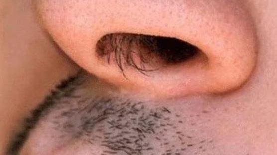 疾病|鼻毛外窜的男人，有何不同之处？鼻毛变白说明了什么？涨知识了