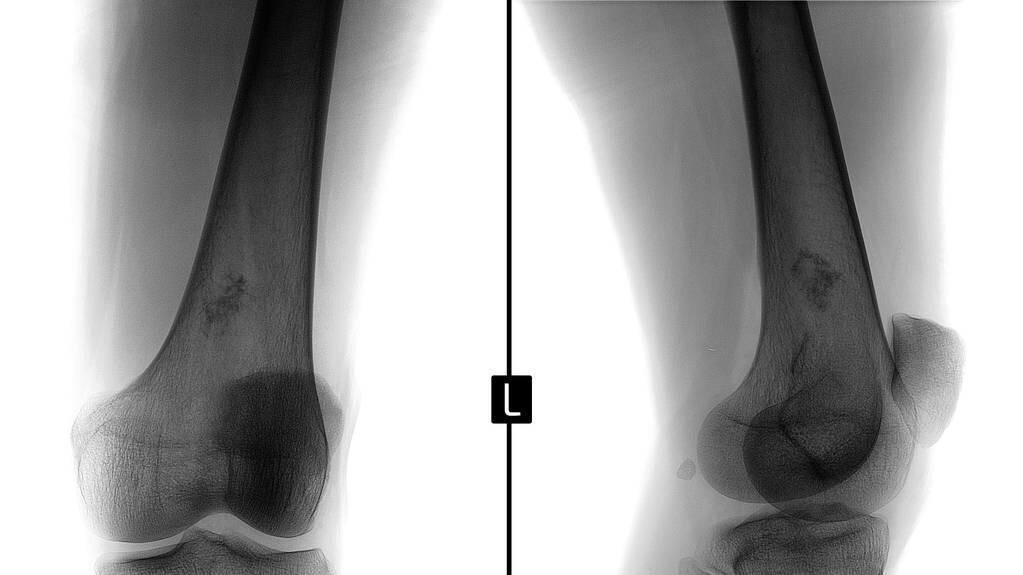 运动|岁月不败美人，如今51岁，再次刷新了我对年龄的认知，运动很重要
