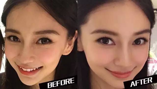 |才20多岁眼周肌肤就出bug了，关晓彤、吴宣仪的黑眼睛无所遁形了