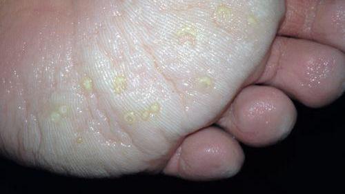 |脚上神秘的“三大特点”， 竟然说明寿命长