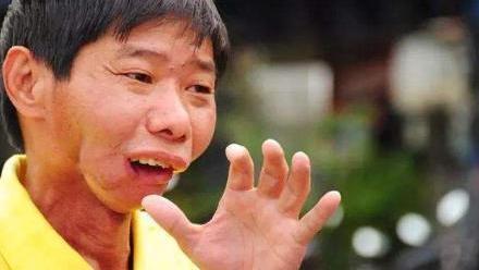 甲状腺|欧美国家已禁售的“致癌水果”，比烟酒还伤甲状腺，劝你管住嘴