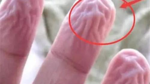 面膜|你不得不知道的皮肤知识