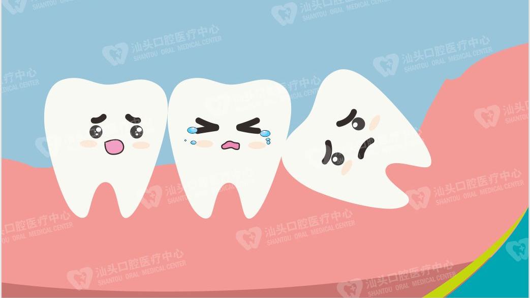 肿瘤|智齿发炎为何不能直接拔牙？