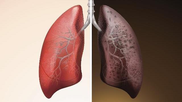 |肺好不好看手，若手上没有这3个表现，恭喜，肺部还算健康！