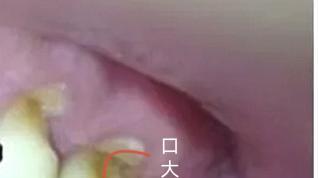 |牙友：口腔科普丨你不会还用拉锯式刷牙吧？