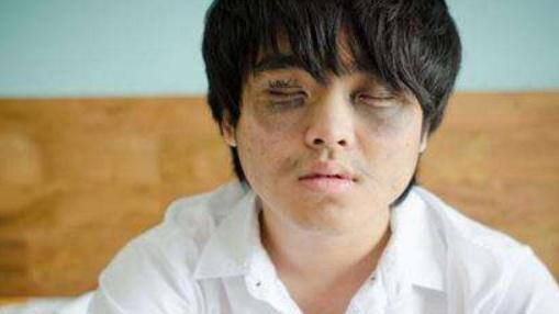 |男人若出现“1黑2臭”，可能是肾脏支撑不住了，早知早治为好