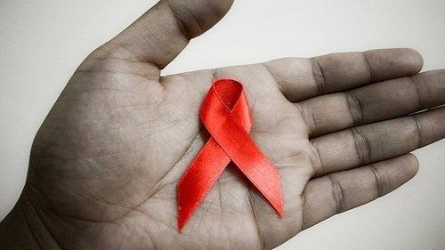 疾病|艾滋病的潜伏期是多久？具体有哪些表现？专家在此告诉你答案！