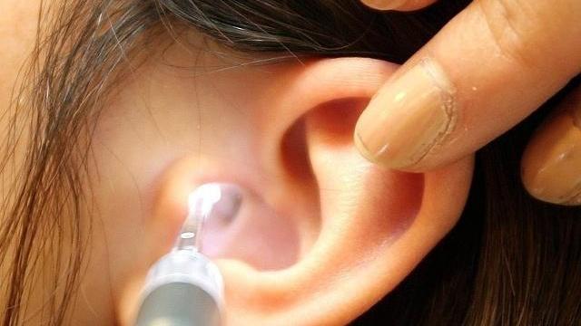 李士懋|耳科医生：耳朵孔里经常痒，可能预示着有这些问题，一定要注意！