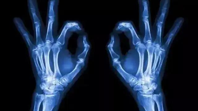 医生|影像放射科医生告诉你做X光、核磁共振、螺旋CT、B超这些检查到底有什么用？