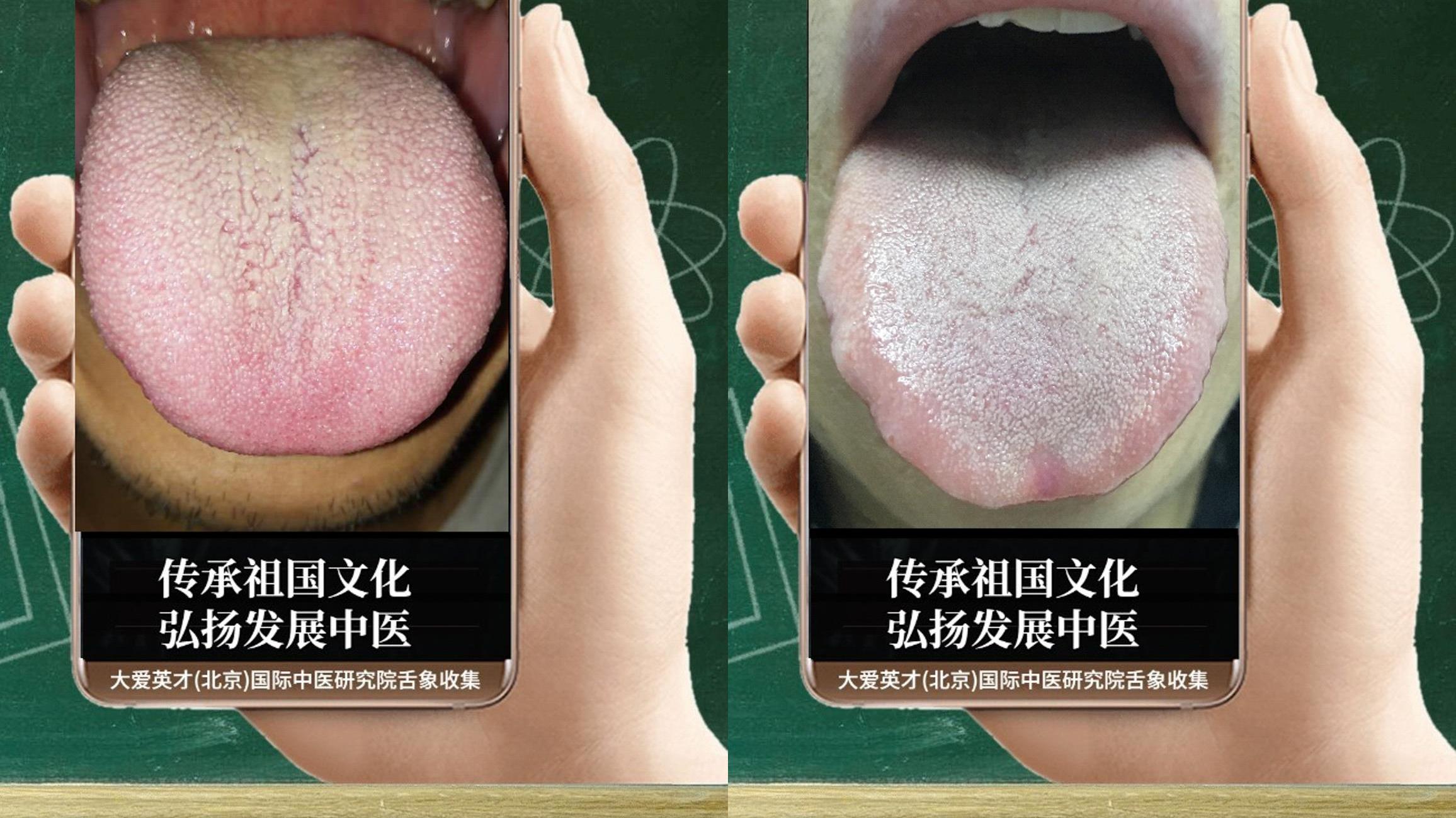 |中医医案：总是心烦气短，胸闷痰多，容易出汗，肝木不和