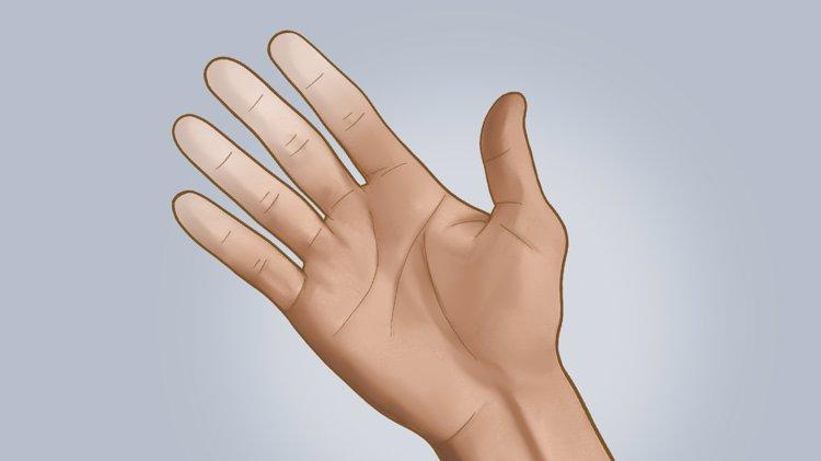 前列腺癌|男性右手无名指长于食指，患前列腺癌风险高？是科学还是谣言