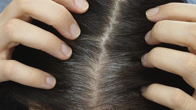 经典|哈佛大学研究表明：长白头发的人不易患癌？到底有没有科学依据？