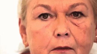 衰老|皮防科普丨抗皱，你知道它的类型吗？