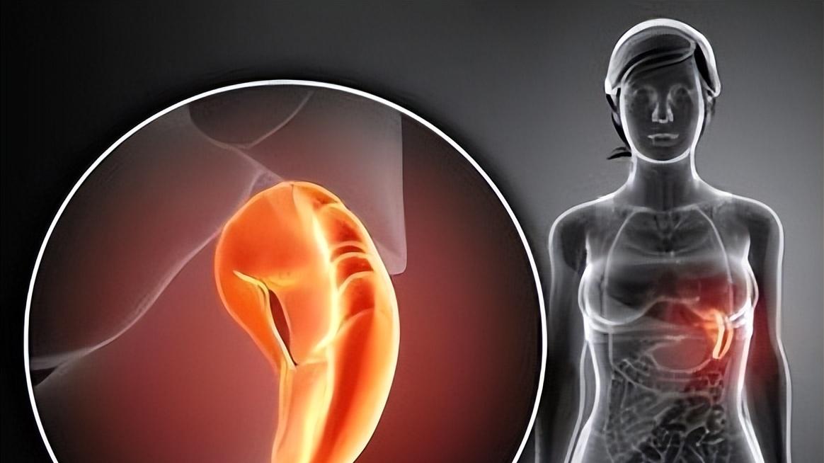 健脾|万病归于脾，脾健病无踪，送你4个中成药，健脾养脾，祛湿和胃