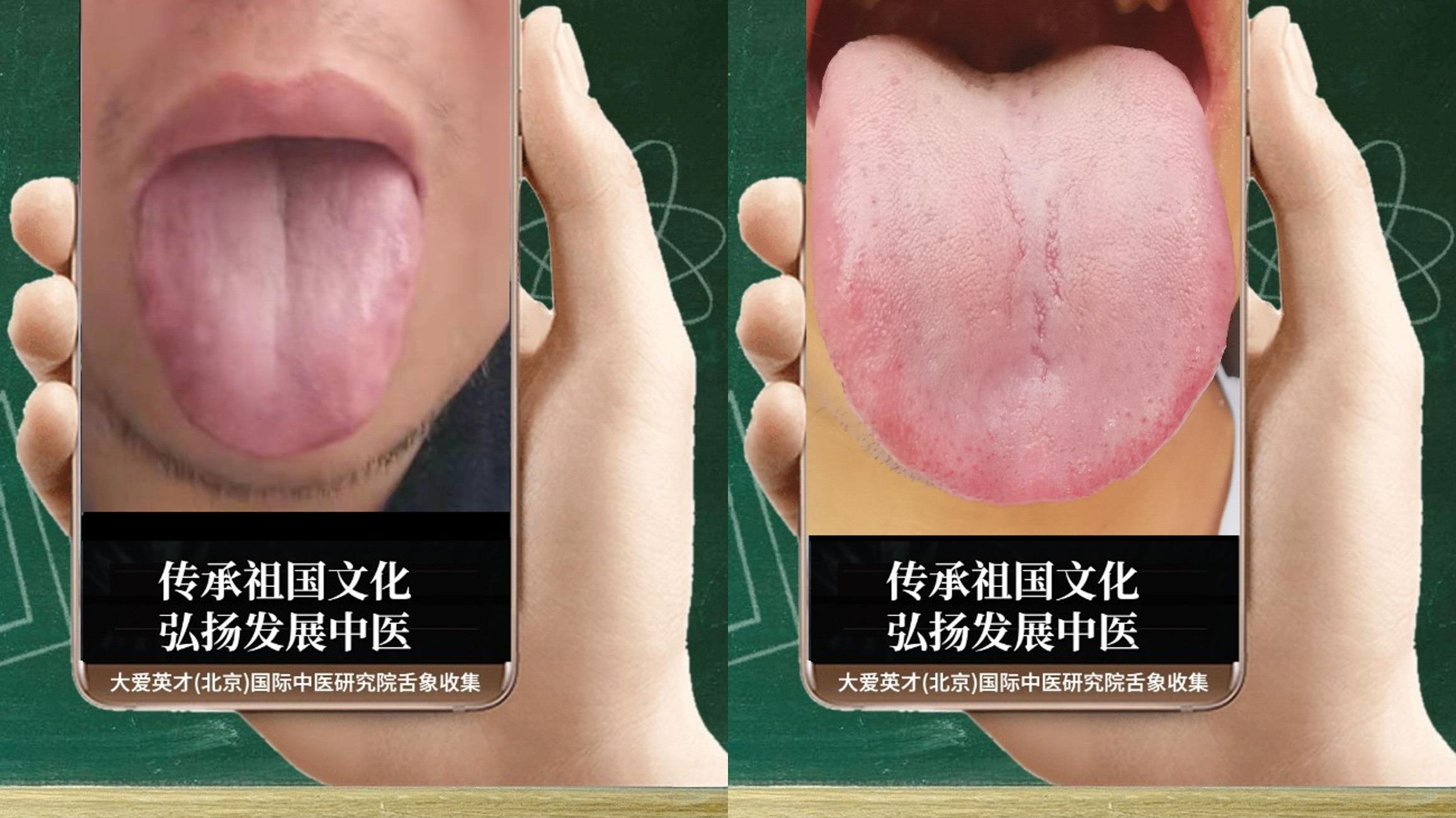 心脏|中医解析：怕生冷，记忆力下降，气喘痰多，反反复复很不舒服