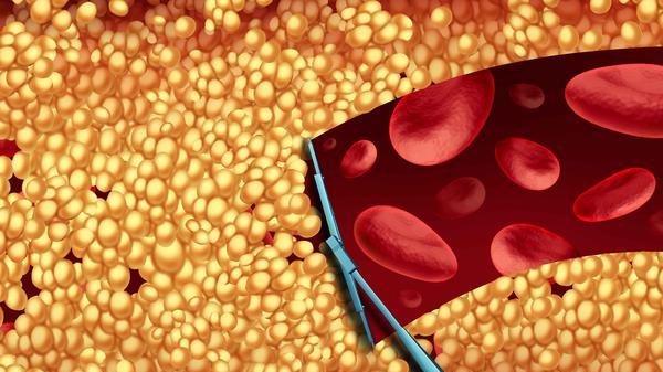 绿茶|查出胆固醇高时，要清楚做好这4件事，或能降低胆固醇，需了解