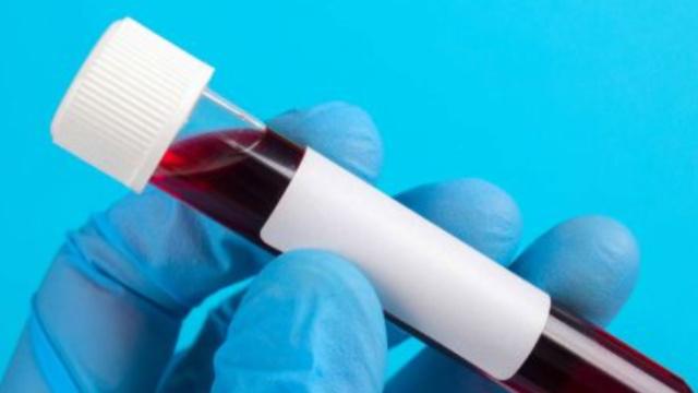 脂肪酸|人若感染艾滋病，多长时间会被发现？可能多数人误认为是皮肤病！