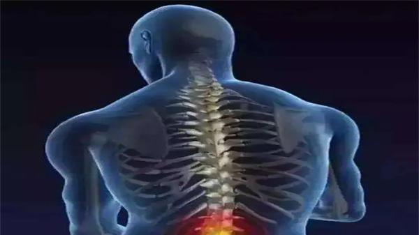 胃酸|得了腰椎间盘突出症要怎么办？记住这几点千万不能做