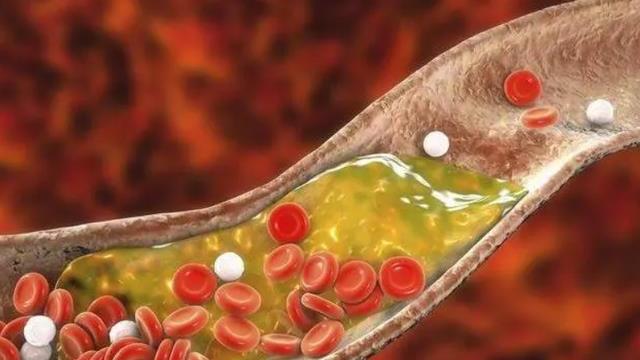 痰液|91岁陈院士，研究血脂50多年，提醒：除了肉，这3种蔬菜也要少吃