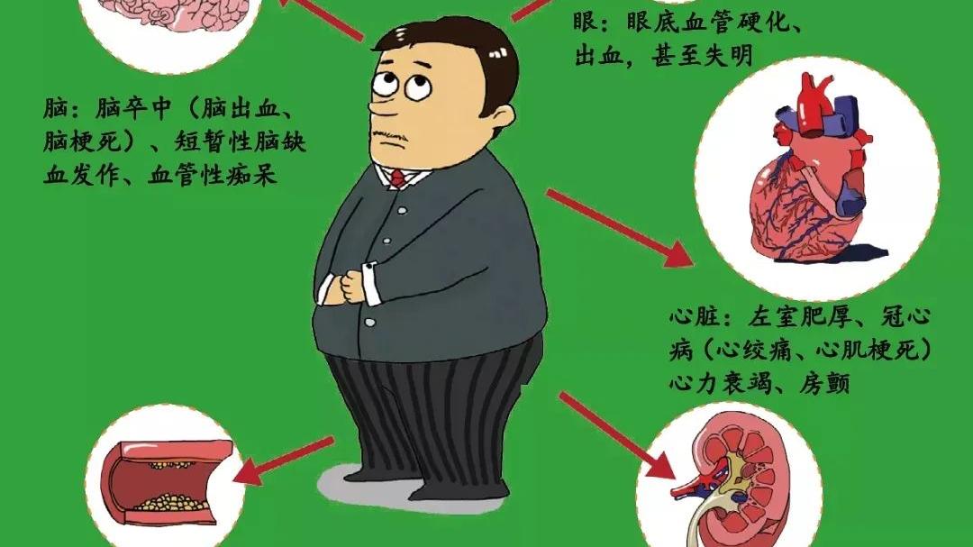 高血压|高血压我知道！「高血压危象」是什么? 应如何防范?