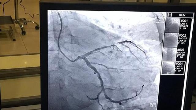 苹果|心脏不舒服：心电图、心脏彩超、心脏造影，哪个检查最准确？
