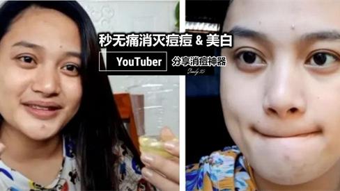 祛痘 祛痘产品哪个品牌效果好？COS评选真正有效的祛痘产品排行榜