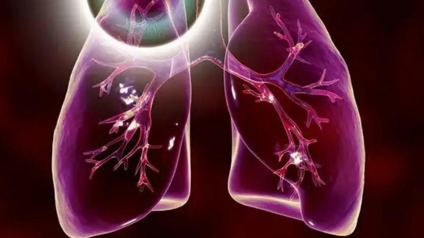 饮食|肺结节到底是什么？对人体有危害吗？应该如何预防？