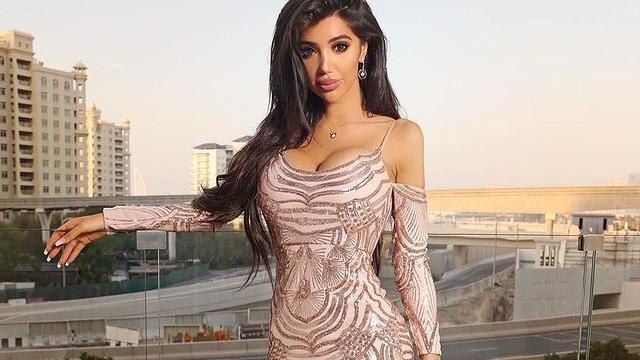 整容|克洛伊·坎又一个整容明星！坦言已花费130万美元，未来还要继续