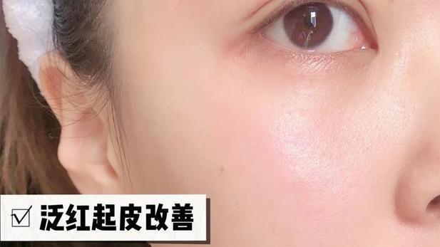 护肤品 被大牌“埋没”的5款老国货，虽然包装只能打20分，但使用效果100分