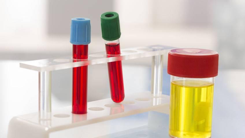 尿酸|睡觉时，若有这4个异常，要引起重视，多半是尿酸过高了