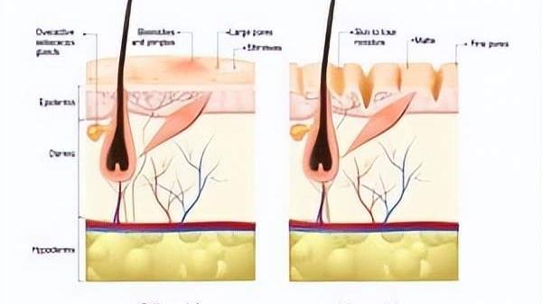 护肤|油性皮肤怎么改善？这份早6晚7的护肤指南，摆脱油腻脸