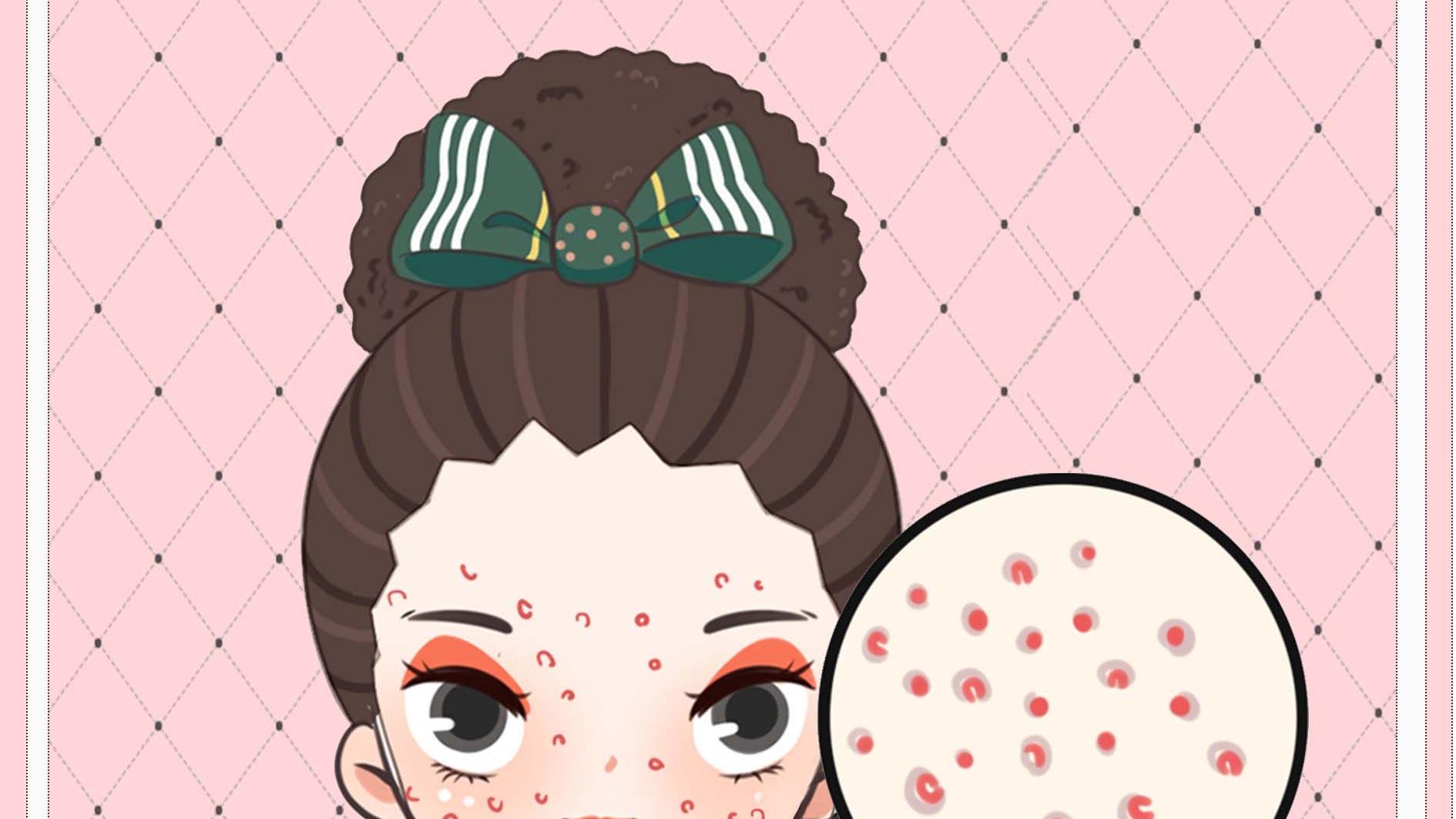 短发 祛痘膏在护肤哪个步骤