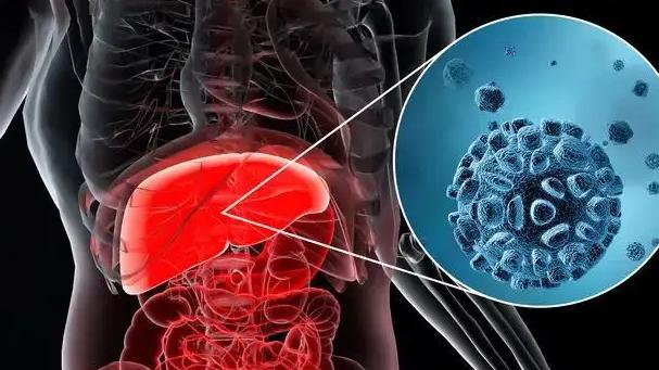 肝脏|肝内有癌，手先知？指甲出现“3”处异常，需注意，趁早检查肝CT