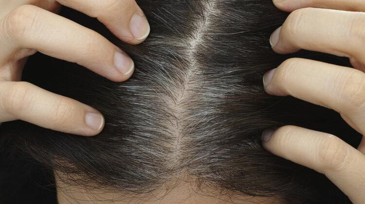 哈佛研究：长白头发的人不易患癌，真的吗？白了的发怎么黑回去？