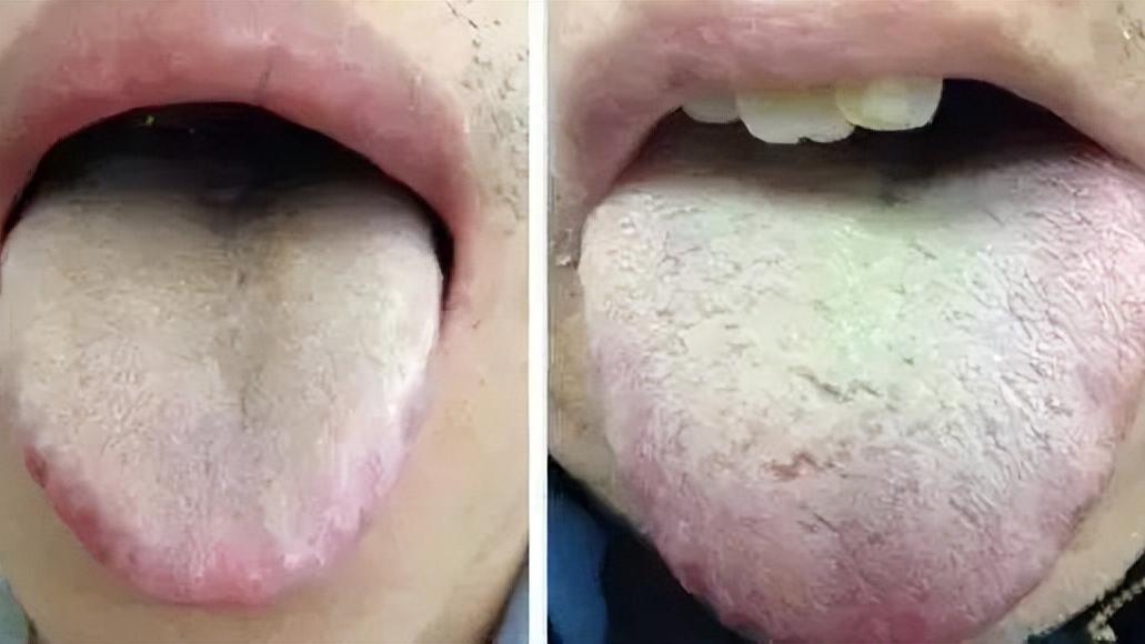 蔬菜|疝气反复发作，多和这三个原因有关，中医教你如何从根源上除疝