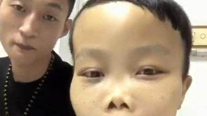 花滑|“外星人”陈山升级当爸爸，婴儿外表无异常，被怀疑是不是亲生的