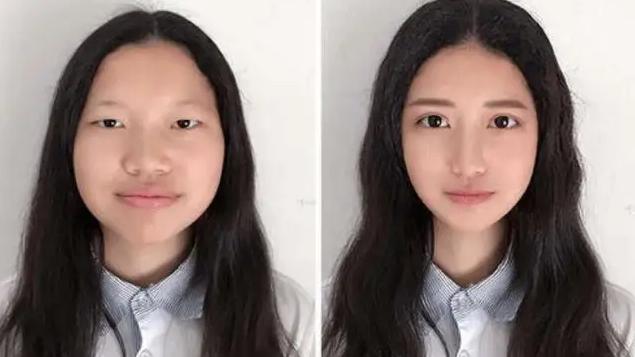 发型 为什么做美容手术，我都坚持以面诊为准！