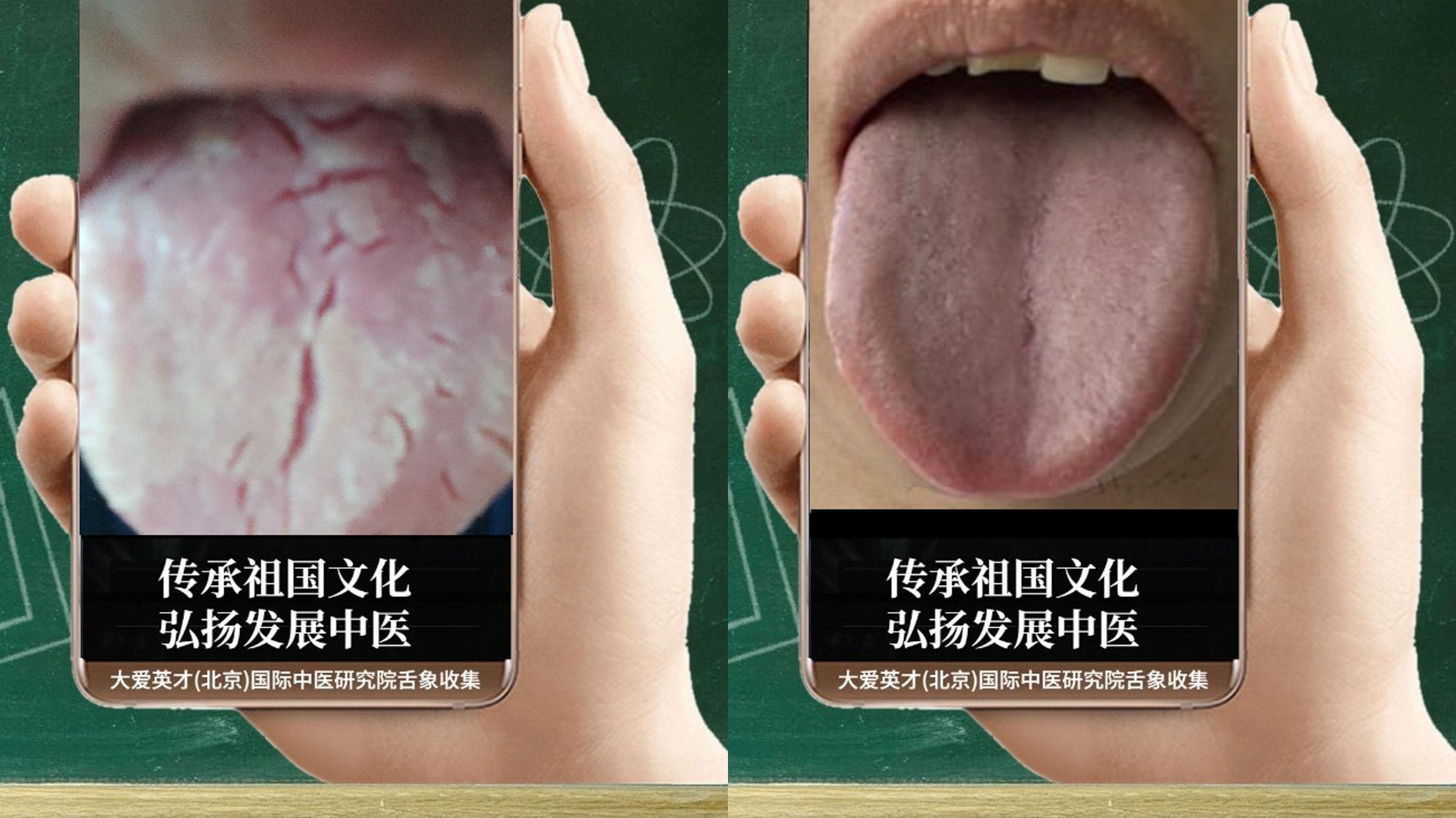 安神|中医病症：懦弱、手足心热、痰多色白、一直未愈很难受