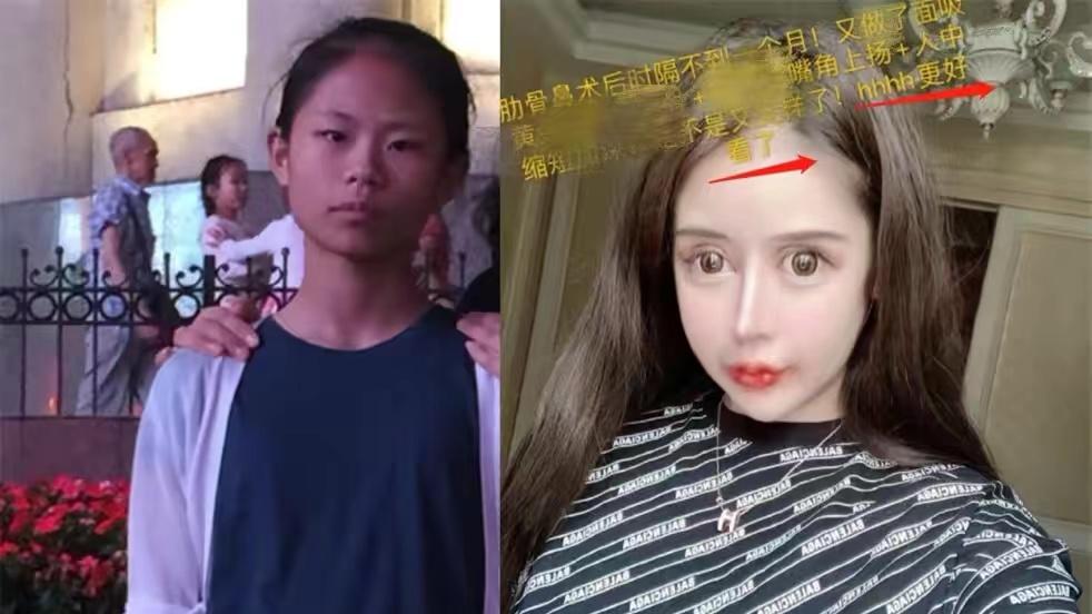 周楚娜|“真人芭比”周楚娜：花费400万整容上百次，一张脸抵一辆跑车