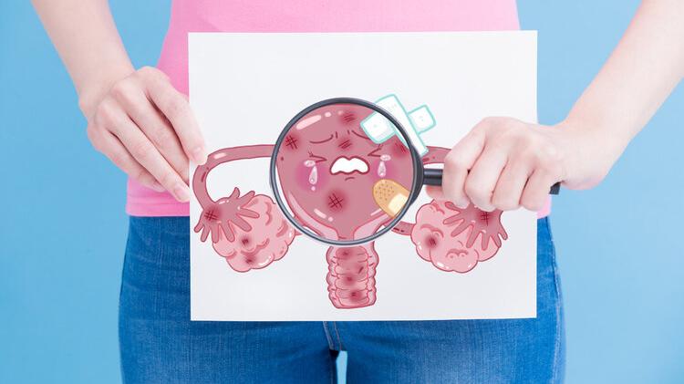 子宫肌瘤|女性为什么容易长子宫肌瘤？提醒：平时尽量避免3个行为，别忽视