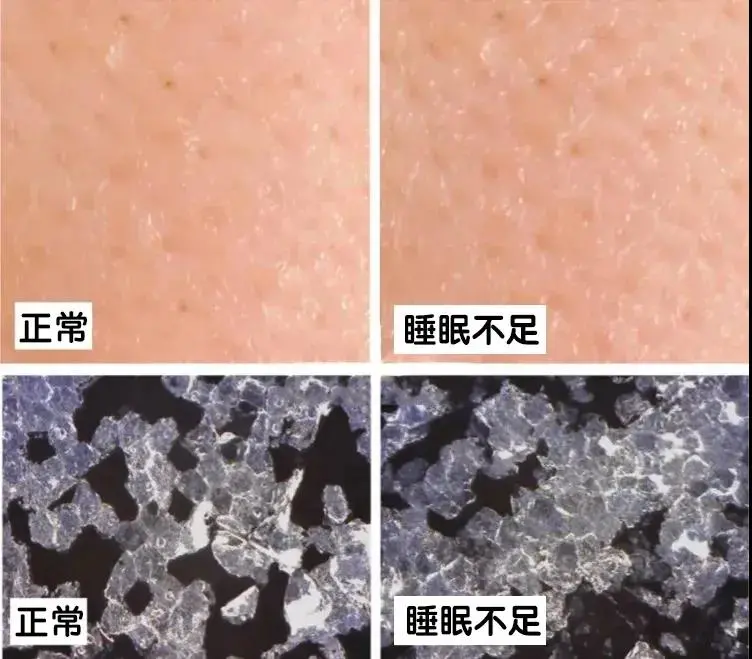 熬夜 护肤指南｜那些不得不熬的夜，如何拯救熬夜脸？
