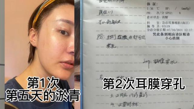 |徐大宝自曝遭家暴，被小5岁老公暴打4次，贾洪清暗指老婆出轨在先