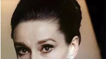 【矫正中必读篇】正畸界颜值杀手之牙套脸