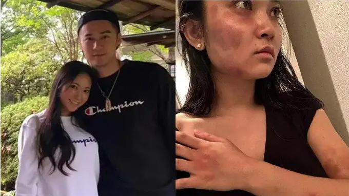 整容|盘点过气艺人现状：哭穷只剩100w，无业只能送外卖，靠整容博关注