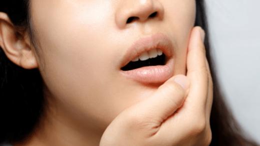 牙周炎|国医大师薛已：牙周炎，先治胃！这张方子，请你仔细看一看