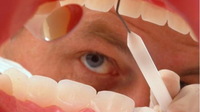 养生|生活小知识，一招去除牙齿上臭烘烘的石头