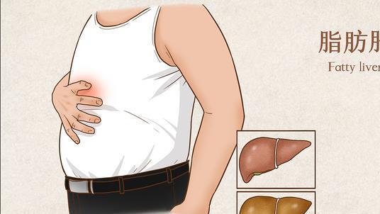 脂肪肝|滴酒未沾，怎么会得了脂肪肝呢？脂肪肝究竟和什么相关？
