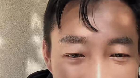 汪小菲|汪小菲被爆挨打后，首次开启直播，眼眶发青状态引人担忧