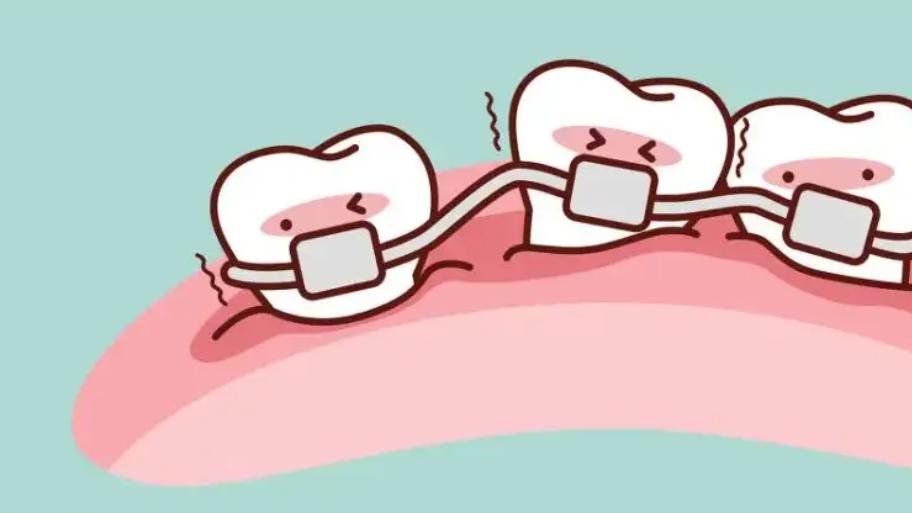 痔疮|牙齿矫正定期复诊的重要性体现在哪里？