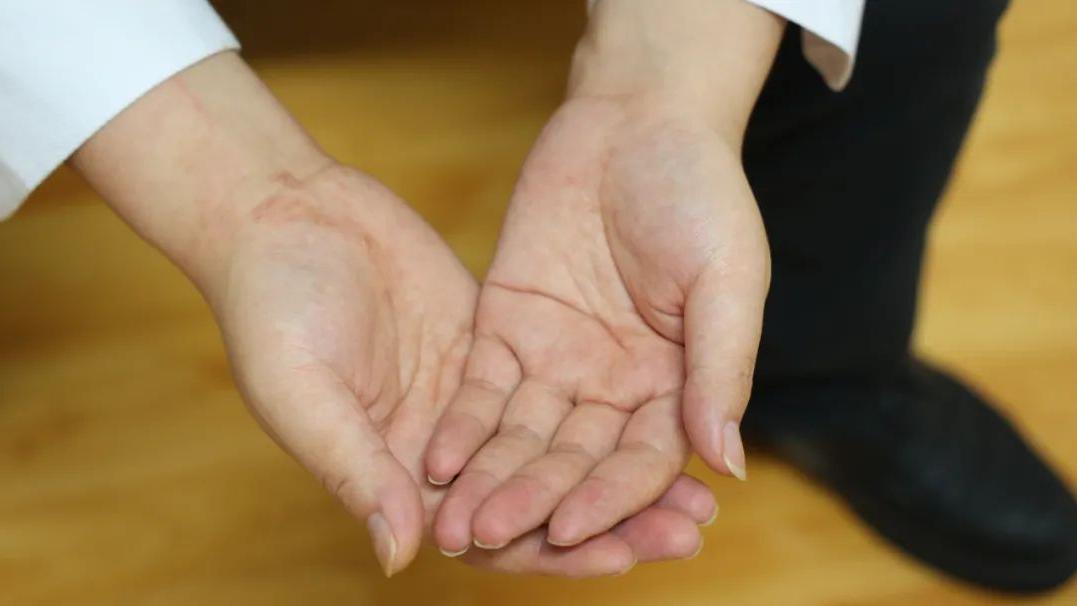 肾虚|男人的肾功能下降，3个部位会“汗如雨下”，别不自知